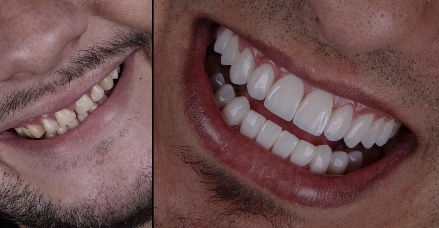 Sorriso transformado — resultado do Método Coy